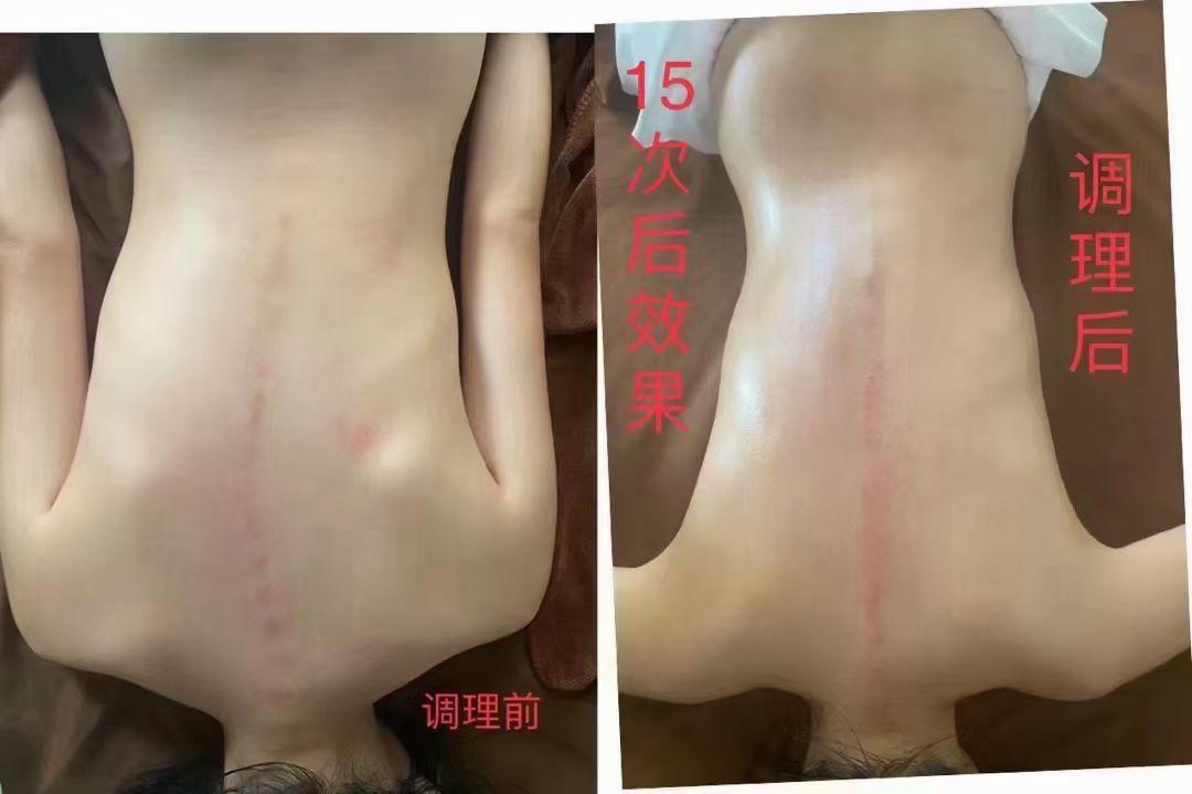 SKYE Aesthetics — Body Contouring 01