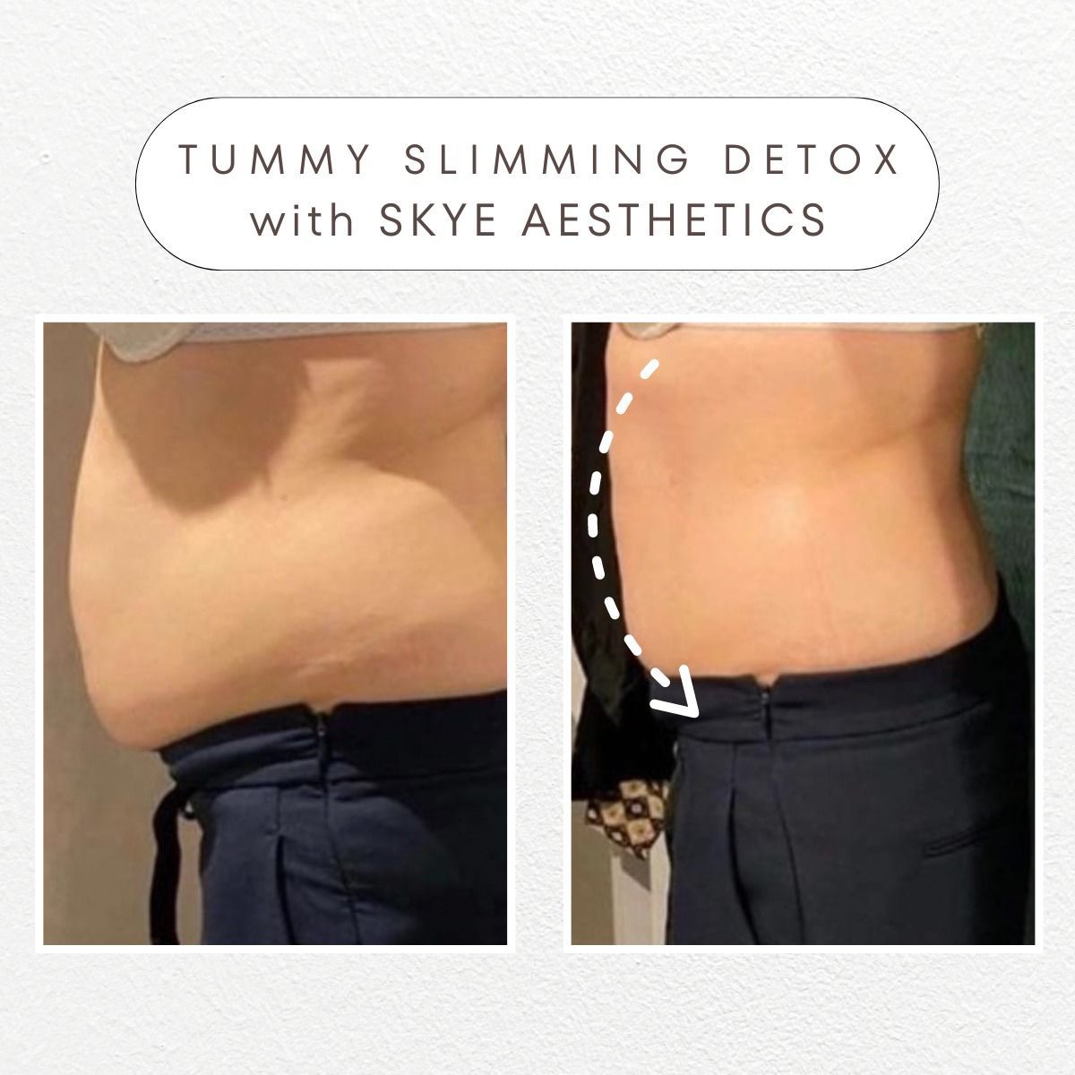 Speedy Detox Treatment: A One-Session Reset for Desk-Bound Bodies
